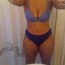 3 1/2 months post- op
