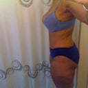 3 1/2 months post- op