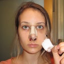 day after surgery...Good lord.... hahah my forehead and eyes were swollen!