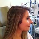 Day of cast removal profile view
