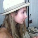 day 4 post cast removal, profile view