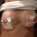 Day of surgery.