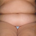 This was the hardest thing to do. Upload pics! ARG!!! I have always said, this looks like a barrel with legs attached! Cannot wait for the after results!