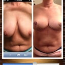 Before and after