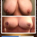 Before and after