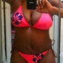 20 days post tt, first time taking pictures with my bikini on after the tt