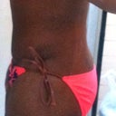 side view, still can see a small hint of my bruises from the liposuction.
