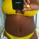 21 days post tt front view close up