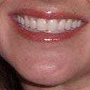 AFTER (no lipstick just clear gloss)
