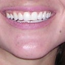 BEFORE (teeth appear whiter)