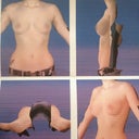 3-d Rendering of what I will possibly look like after surgery
