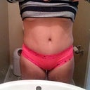 2 Months Post Op
