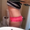 2 Months Post Op