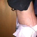 4 day post ops