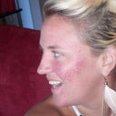 this is my Before picture...