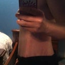 a side view. 8 weeks po