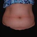 Lower abdomen and love handles