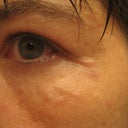 dec 8four hours post injections