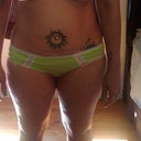 Front view of my tummy before surgery