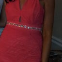 this was taken at my engagement party on June 16th. I am 2 months & 1 week post op. Kind of hard to see it is off of my phone but my tip looks more defined if you look closely.. ;)