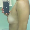 Left Side