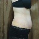 1 week after