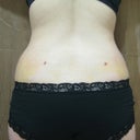 1 week after