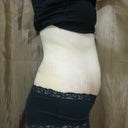 2 weeks after