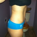 4.5 months post op