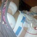 This is me 1 hour post op mommy makeover.