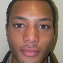 34 Year Old Man Has Rhinoplasty