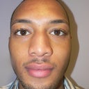 34 Year Old Man Has Rhinoplasty