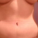 Eight weeks post op (after two days of bedrest and a stomach bug...flattest pic I've taken since surgery)