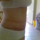 27 days after surgery