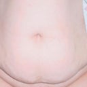 Before surgery picture