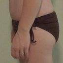 Before Surgery