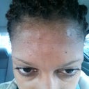 Immediately after injections.