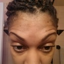 Day after injections raising eyebrows.