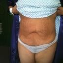 Just before op