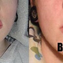 Before and after (side by side)