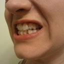 15 - Left side