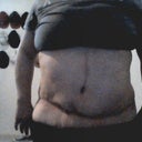 oh ok i had TT in april 2012 with Dr Carbal... im every sad about it!!! and i need to fix it asap!!