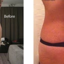 before and after at 6 weeks - VERY HAPPY