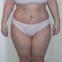 5 weeks po