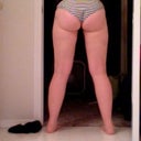 lipo of the love handles seems to be a little swollen still but better than before so i will take it!!!