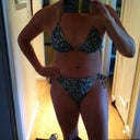 Day 16 post op. Scar is already getting less obvious