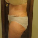 left side 121612 14 po