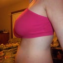 left side 3 weeks post op