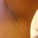 left armpit incision