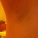 right armpit incision